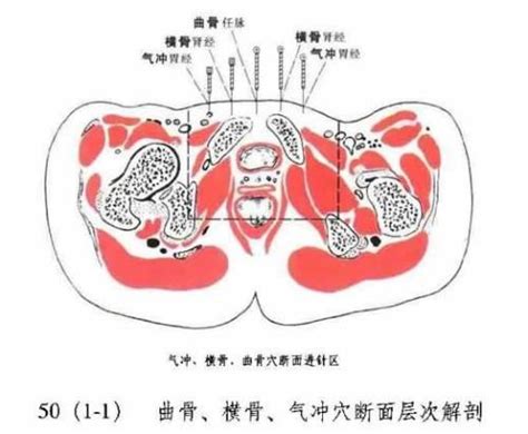 氣沖穴|氣沖:功能作用,治法,定位,解剖,主治,操作,臨床運用,配伍,附註,相關。